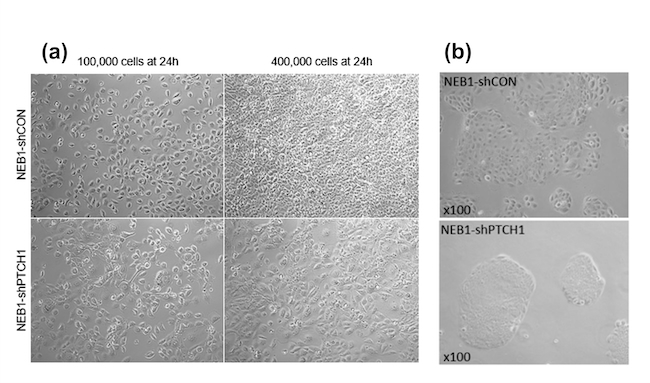 Proliferation of NEB1 cells (skin models) cultured in a 6-well plate and (a) cell morphology of the cultured cells after 24 hours. (b) Morphology of NEB1-shCON (healthy) and NEB1-shPTCH1 (cancerous) cells cultured in normal, lower density, for 4 days